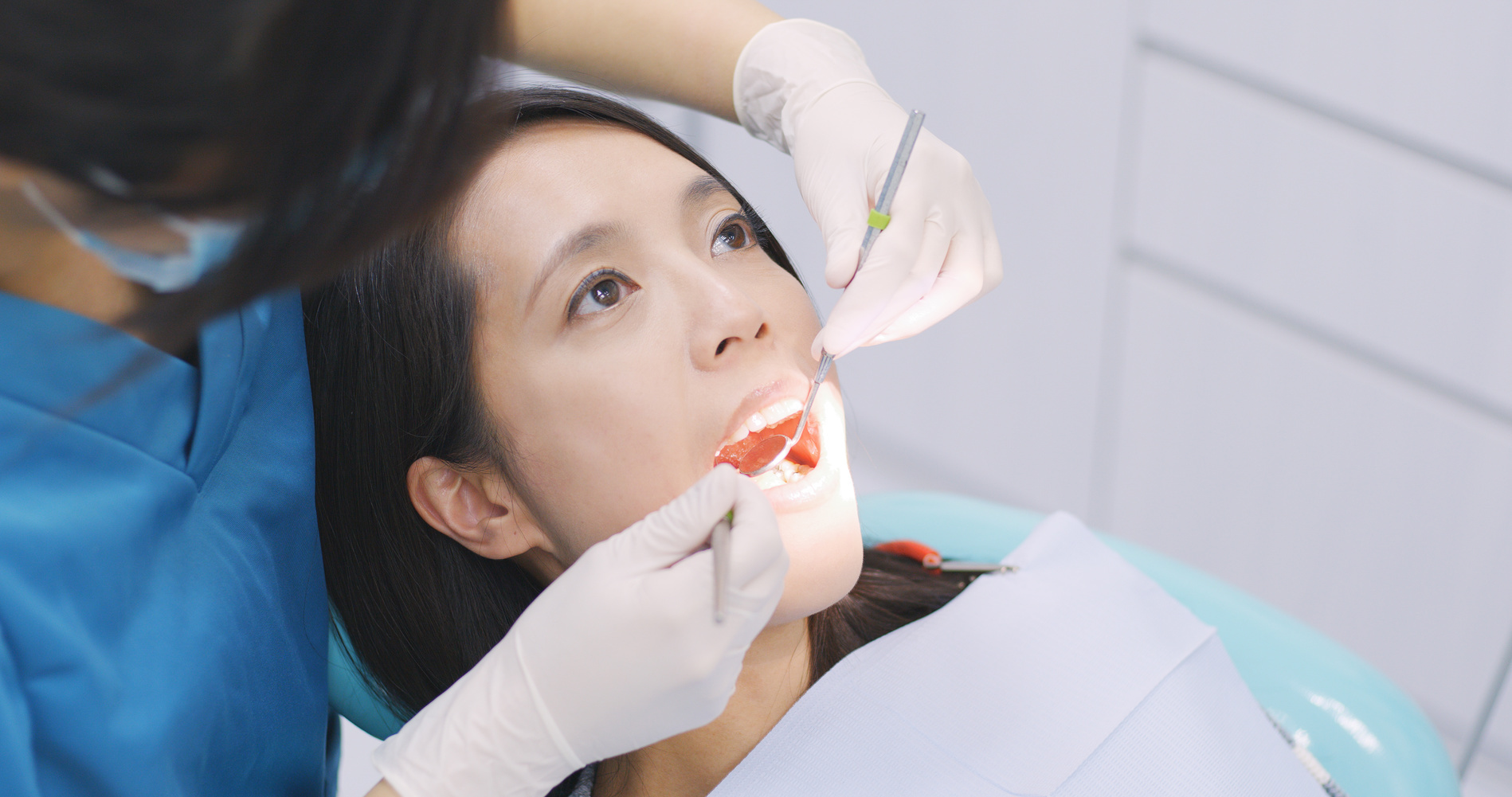 歯を治療している女性